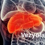 Vezyolatens